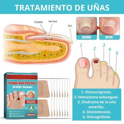 16 Parches Tratamiento Hongo Uñas